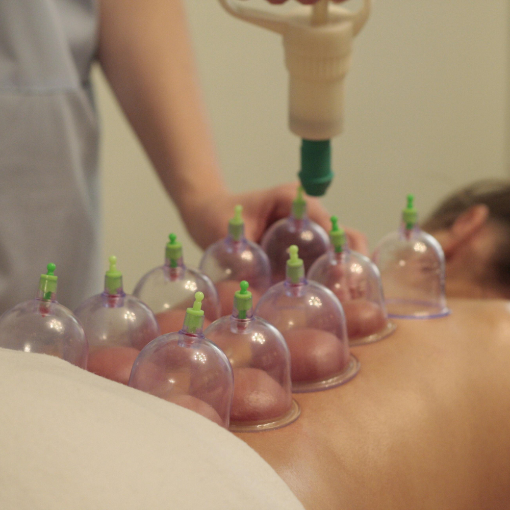 A köpölyözés titka: Miért jelenik meg a piros folt, és hogyan oldja a mély fájdalmat?